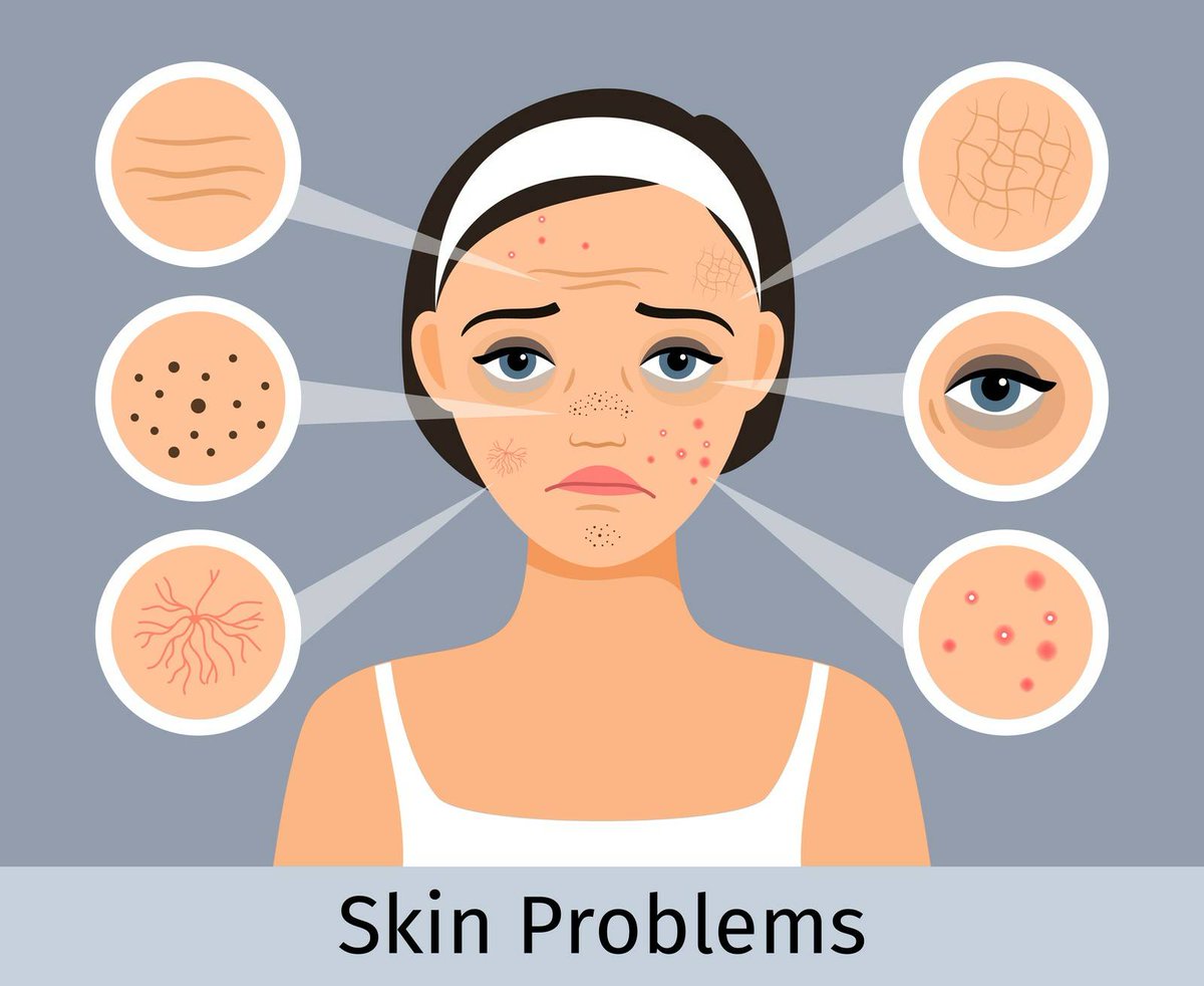 Skin Problems